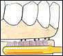 TePe Implant/Orthodontic brush