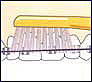TePe Implant/Orthodontic brush