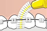 ortho