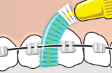 ortho