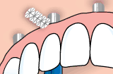 ortho